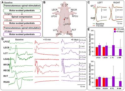 A novel minimally invasive and versatile kyphoplasty balloon-based model of porcine spinal cord injury